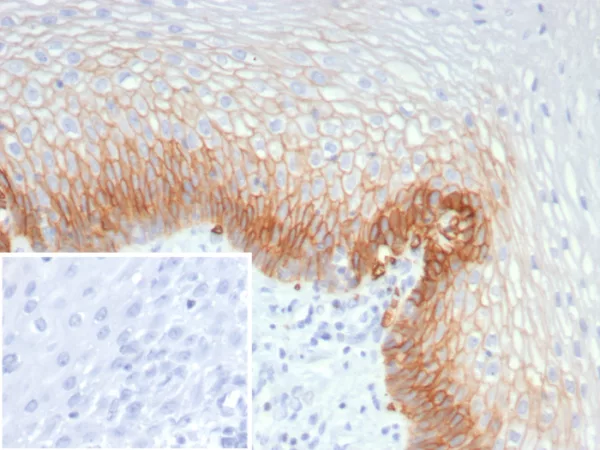 Formalin-fixed, paraffin-embedded human esophagus stained with GLUT-1 Mouse Monoclonal Antibody (GLUT1/7308). Inset: PBS instead of primary antibody; secondary only negative control.