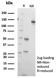 SDS-PAGE Analysis of Purified SLC18A2 Mouse Monoclonal Antibody (SLC18A2/7983). Confirmation of Purity and Integrity of Antibody.