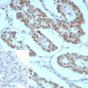Formalin-fixed, paraffin-embedded human prostate stained with INI-1 Recombinant Mouse Monoclonal Antibody (rINI1/8850) Inset: PBS instead of primary antibody; secondary only negative control.