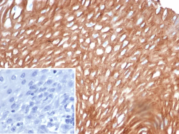 Formalin-fixed, paraffin-embedded human esophagus stained with SI-CLP / CHID1 Mouse Monoclonal Antibody (CHID1/6368) Inset: PBS instead of primary antibody; secondary only negative control.
