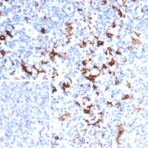 IHC analysis of formalin-fixed, paraffin-embedded human kidney.  Cytoplasmic staining using FSCN1/7207 at 2ug/ml in PBS for 30min RT. Inset: PBS instead of primary antibody; secondary only negative control.