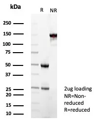SDS-PAGE Analysis of Purified Superoxide Dismutase 1 Mouse Monoclonal Antibody (SOD1/4593). Confirmation of Integrity and Purity of Antibody.