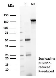 SDS-PAGE Analysis of Purified SOX12 Mouse Monoclonal Antibody (PCRP-SOX12-1E4). Confirmation of Purity and Integrity of Antibody.