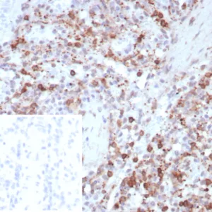 Formalin-fixed, paraffin-embedded human spleen stained with Osteonectin Recombinant Mouse Monoclonal Antibody (rOSTN/8527). Inset: PBS instead of primary antibody; secondary only negative control.