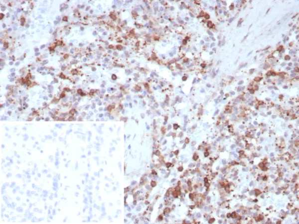 Formalin-fixed, paraffin-embedded human spleen stained with Osteonectin Recombinant Mouse Monoclonal Antibody (rOSTN/8527). Inset: PBS instead of primary antibody; secondary only negative control.