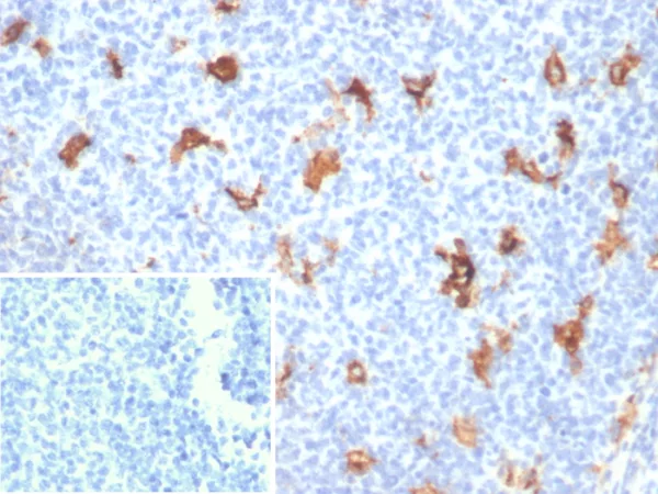 Formalin-fixed, paraffin-embedded human tonsil stained with SPARC / Osteonectin Mouse Monoclonal Antibody (OSTN/3756). Inset: PBS instead of primary antibody; secondary only negative control.