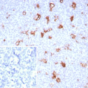 Formalin-fixed, paraffin-embedded human tonsil stained with Osteonectin Recombinant Rabbit Monoclonal Antibody (OSTN/8528R). Inset: PBS instead of primary antibody; secondary only negative control.