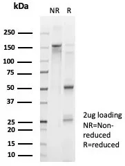 SDS-PAGE Analysis of Purified FOXL2 Mouse Monoclonal Antibody (PCRP-FOXL2-1B4). Confirmation of Purity and Integrity of Antibody.