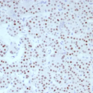 Formalin-fixed, paraffin-embedded human parathyroid stained with FOXL2 Recombinant Rabbit Monoclonal Antibody (FOXL2/8701R). HIER: Tris/EDTA, pH9.0, 45min. 2: HRP-polymer, 30min. DAB, 5min.