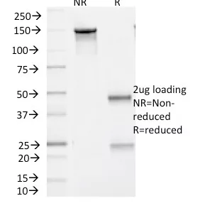 SDS-PAGE Analysis of Purified BRAF Mouse Monoclonal Antibody (V600E/1321). Confirmation of Purity and Integrity of Antibody.