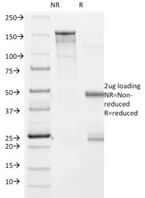 SDS-PAGE Analysis of Purified BRAF Mouse Monoclonal Antibody (V600E/1322).                          Confirmation of Purity and Integrity of Antibody.