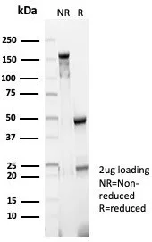 SDS-PAGE Analysis of Purified BRCA2 Mouse Monoclonal Antibody (BRCA2/2158). Confirmation of Integrity and Purity of Antibody.