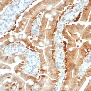 Formalin-fixed, paraffin-embedded human small intestine stained with SULT1E1 Mouse Monoclonal Antibody (SULT1E1/7124). HIER: Tris/EDTA, pH9.0, 45min. 2°C: HRP-polymer, 30min. DAB, 5min.