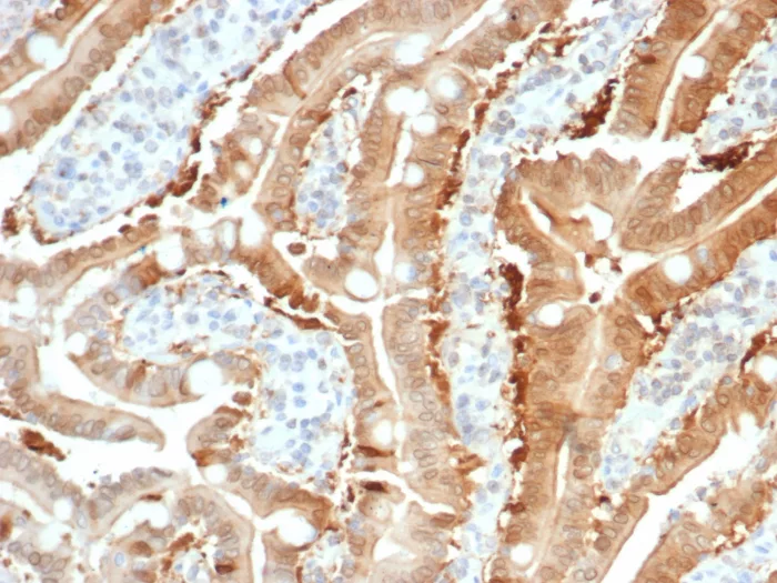 Formalin-fixed, paraffin-embedded human small intestine stained with SULT1E1 Mouse Monoclonal Antibody (SULT1E1/7124). HIER: Tris/EDTA, pH9.0, 45min. 2°C: HRP-polymer, 30min. DAB, 5min. Sulfotransferase family 1E, estrogen-preferring, member 1 Antibody