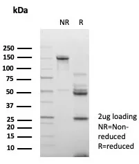 SDS-PAGE Analysis of Purified CD147 Mouse Monoclonal Antibody (BSG/7950). Confirmation of Integrity and Purity of Antibody.