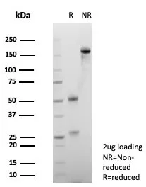 SDS-PAGE Analysis of Purified CD147 Mouse Monoclonal Antibody (BSG/7949). Confirmation of Integrity and Purity of Antibody.