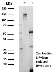 SDS-PAGE Analysis CD147 Recombinant Rabbit Monoclonal Antibody (BSG/9223R). Confirmation of Purity and Integrity of Antibody.