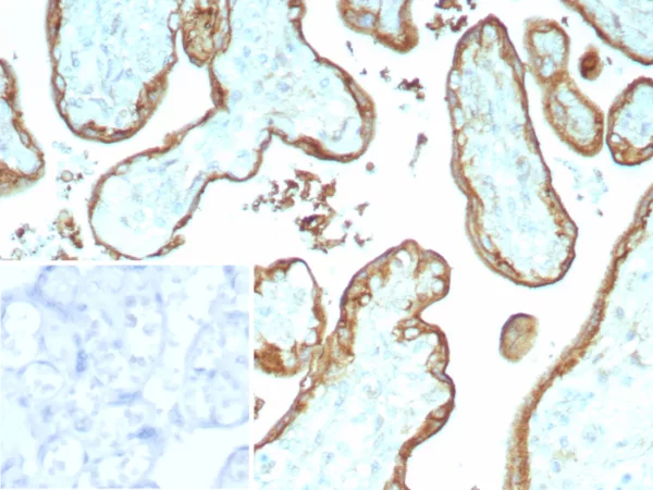 Formalin-fixed, paraffin-embedded human placenta stained with CD147 Recombinant Rabbit Monoclonal Antibody (BSG/9223R). Inset: PBS instead of primary antibody; secondary only negative control.