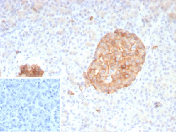 Formalin-fixed, paraffin-embedded human pancreas stained with Synaptophysin Recombinant Mouse Monoclonal Antibody (rSYP/8807). Inset: PBS instead of primary antibody; secondary only negative control.