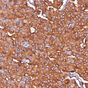 Formalin-fixed, paraffin-embedded human adrenal stained with Synaptophysin Recombinant Rabbit Monoclonal Antibody (SYP/7976R). HIER: Tris/EDTA, pH9.0, 45min. 2: HRP-polymer, 30min. DAB, 5min.