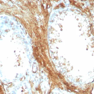 Recombinant Transgelin (SM22-alpha) Antibody