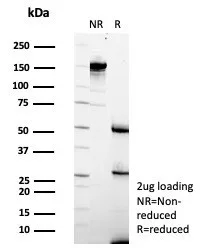 SDS-PAGE Analysis of Purified TCF7 Mouse Monoclonal Antibody (TCF7/7631). Confirmation of Purity and Integrity of Antibody.
