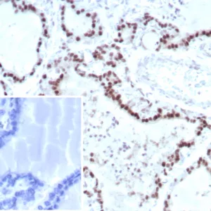 IHC analysis of formalin-fixed, paraffin-embedded human thyroid.  Nuclear staining using TFE3/8663R at 2ug/ml. Inset: PBS instead of primary antibody; secondary only negative control.