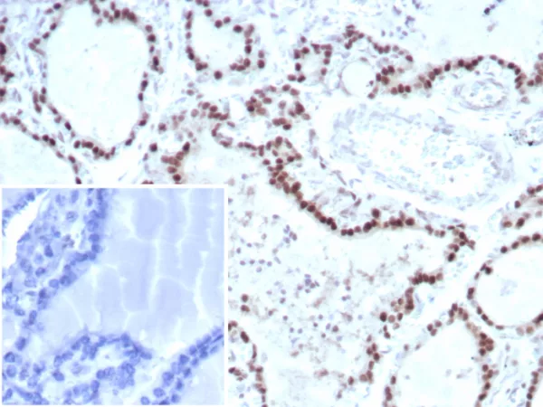 IHC analysis of formalin-fixed, paraffin-embedded human thyroid.  Nuclear staining using TFE3/8663R at 2ug/ml. Inset: PBS instead of primary antibody; secondary only negative control.