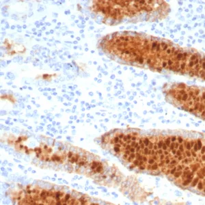 Formalin-fixed, paraffin-embedded human stomach stained with Transferrin Mouse Monoclonal Antibody (TF/7770). HIER: Tris/EDTA, pH9.0, 45min. 2°C: HRP-polymer, 30min. DAB, 5min.