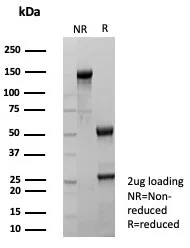 SDS-PAGE Analysis of Purified Transferrin Recombinant Mouse Monoclonal Antibody (rTFF1/9134). Confirmation of Purity and Integrity of Antibody.