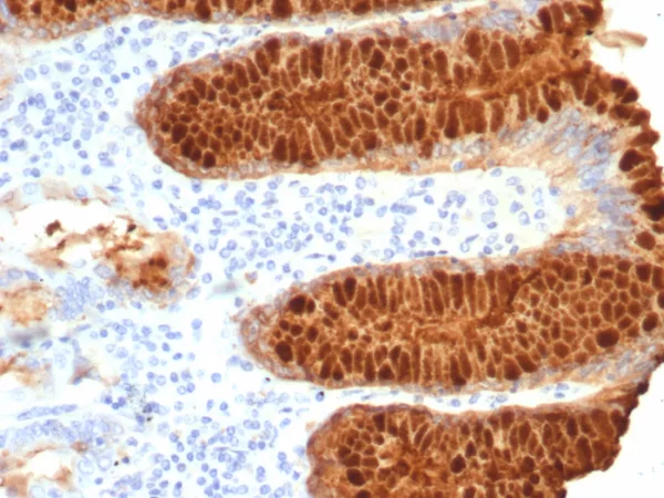 Formalin-fixed, paraffin-embedded human stomach stained with Transferrin Mouse Monoclonal Antibody (TF/7768). HIER: Tris/EDTA, pH9.0, 45min. 2: HRP-polymer, 30min. DAB, 5min.