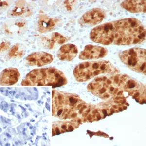 Formalin-fixed, paraffin-embedded human stomach stained with Transferrin Recombinant Rabbit Monoclonal Antibody (TFF1/8755R). HIER: Tris/EDTA, pH9.0, 45min. 2: HRP-polymer, 30min. DAB, 5min.