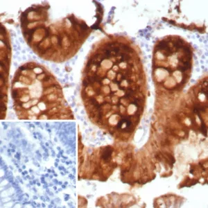 Formalin-fixed, paraffin-embedded human colon stained with Transferrin Recombinant Rabbit Monoclonal Antibody (TFF1/8817R). Inset: PBS instead of primary antibody; secondary only negative control.