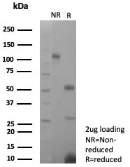 SDS-PAGE Analysis of Purified Transferrin Recombinant Rabbit Monoclonal Antibody (TFF1/8817R). Confirmation of Purity and Integrity of Antibody. Recombinant pS2 / pNR-2 / TFF1 (Estrogen-Regulated Protein) Antibody - Image 3