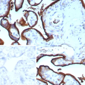 Formalin-fixed, paraffin-embedded human placenta stained with CD71 Rabbit Recombinant Monoclonal Antibody (TFRC/9106R). Inset: PBS instead of primary antibody; secondary only negative control.