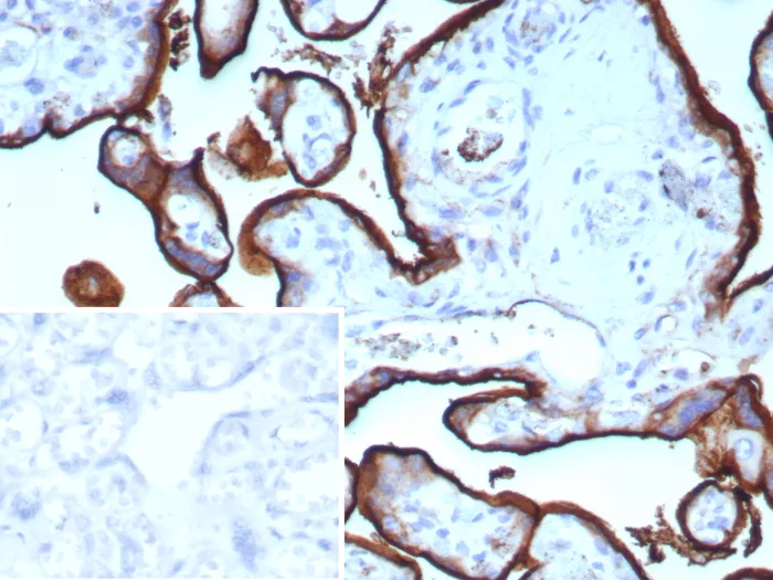 Formalin-fixed, paraffin-embedded human placenta stained with CD71 Rabbit Recombinant Monoclonal Antibody (TFRC/9106R). Inset: PBS instead of primary antibody; secondary only negative control. Recombinant CD71 / Transferrin Receptor (TFRC) (Extracellular Domain) Antibody