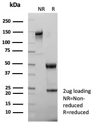 SDS-PAGE Analysis of Purified TGF beta Mouse Monoclonal Antibody (TGFB/7230). Confirmation of Purity and Integrity of Antibody.