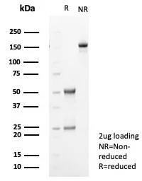 SDS-PAGE Analysis of Purified TGF beta Mouse Monoclonal Antibody (TGFB/7240). Confirmation of Purity and Integrity of Antibody.