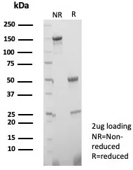SDS-PAGE Analysis of Purified TGFB3 Mouse Monoclonal Antibody (TGFB3/4801). Confirmation of Purity and Integrity of Antibody.
