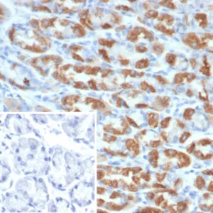 Formalin-fixed, paraffin-embedded human stomach stained with Thrombospondin-1 / THBS1 Mouse Monoclonal Antibody (THBS1/4532). Inset: PBS instead of primary antibody; secondary only negative control.