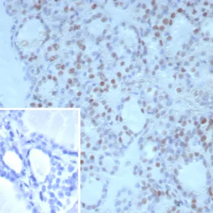Formalin-fixed, paraffin-embedded human thyroid stained with TTF-1 Mouse Monoclonal Antibody (NX2.1/9030). Inset: PBS instead of primary antibody; secondary only negative control.
