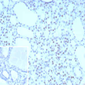 Formalin-fixed, paraffin-embedded human thyroid stained with TTF-1 Mouse Monoclonal Antibody (NX2.1/9031). Inset: PBS instead of primary antibody; secondary only negative control.