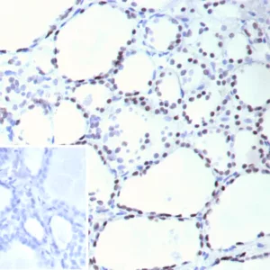 Formalin-fixed, paraffin-embedded human thyroid stained with TTF-1 Mouse Monoclonal Antibody (NX2.1/9036). Inset: PBS instead of primary antibody; secondary only negative control.