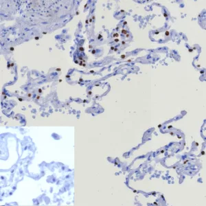 Formalin-fixed, paraffin-embedded human lung stained with TTF-1 Recombinant Rabbit Monoclonal Antibody (TTF1/8123R). Inset: PBS instead of primary antibody; secondary only negative control.