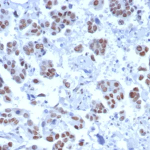 Formalin-fixed, paraffin-embedded human bladder stained with TLE1 Rabbit Recombinant Monoclonal Antibody (TLE1/8007R). HIER: Tris/EDTA, pH9.0, 45min. 2: HRP-polymer, 30min. DAB, 5min.