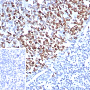 Formalin-fixed, paraffin-embedded human tonsil stained with Topo II alpha Recombinant Mouse Monoclonal Antibody (rTOP2A/8339). Inset: PBS instead of primary antibody; secondary only negative control.