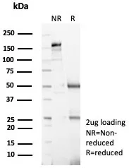 SDS-PAGE Analysis of Purified Topo IIa Recombinant Rabbit Monoclonal Antibody (TOP2A/8103R). Confirmation of Purity and Integrity of Antibody.