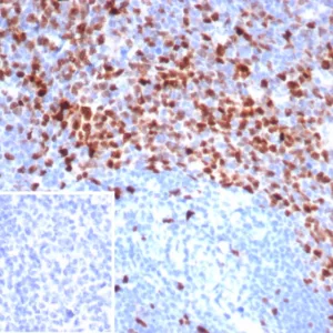 Formalin-fixed, paraffin-embedded human tonsil stained with Topo IIa Recombinant Rabbit Monoclonal Antibody (TOP2A/7169R). Inset: PBS instead of primary antibody; secondary only negative control.