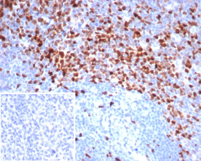 Formalin-fixed, paraffin-embedded human tonsil stained with Topo IIa Recombinant Rabbit Monoclonal Antibody (TOP2A/7169R). Inset: PBS instead of primary antibody; secondary only negative control. Recombinant Topoisomerase II alpha (Proliferation & Drug-Resistance Marker) Antibody