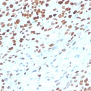 Formalin-fixed, paraffin-embedded human bladder stained with p53 Recombinant Mouse Monoclonal Antibody (rTP53/3889).